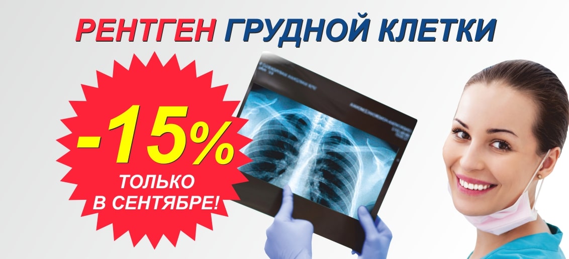 До конца сентября действует скидка 15% на рентген грудной клетки (флюорографию)!