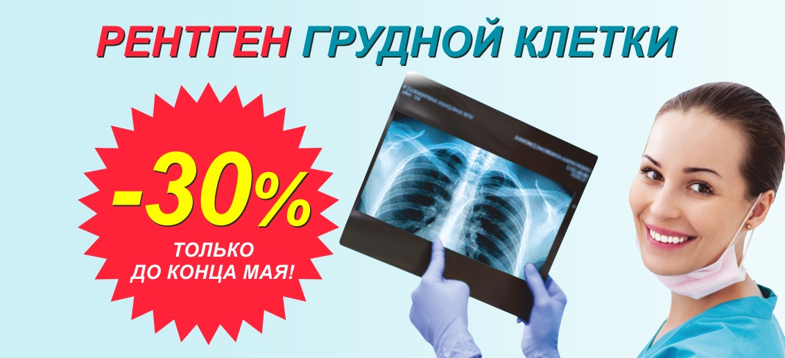 Скидка 30% на рентген грудной клетки (флюорографию) до конца мая!